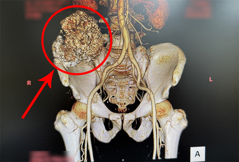 7CB89